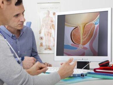 Um urologista consulta um paciente sobre prostatite e métodos de tratamento.